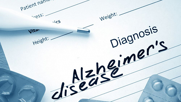 Новый препарат для лечения Альцгеймера успешно прошёл клинические испытания